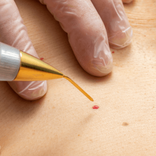 Cirugías menores ambulatorias